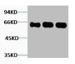 FOS Antibody