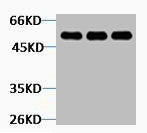TUBB2A Antibody