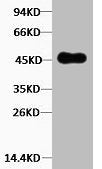 KRT18 Antibody