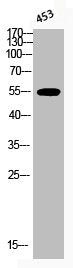 Phospho-AKT1 (T450) Antibody