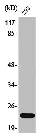 Phospho-EIF4E (S209) Antibody