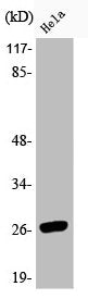 Phospho-HSPB1 (S78) Antibody