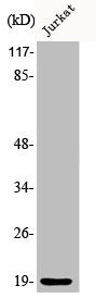 Phospho-STMN1 (S25) Antibody