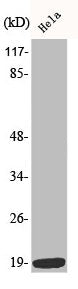 Phospho-STMN1 (S38) Antibody