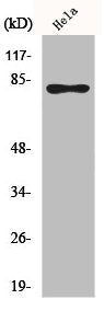 Phospho-RAD17 (S645) Antibody