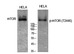 Phospho-MTOR (T2446) Antibody