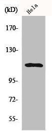 Phospho-STAT2 (Y690) Antibody