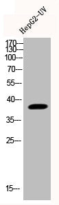 Phospho-MAPK14 (Y323) Antibody