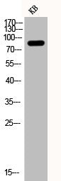 Phospho-PIK3R1 (Y607) Antibody
