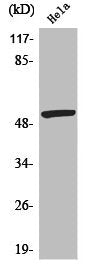 Phospho-MEF2A (S408) Antibody