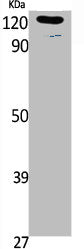Phospho-LEPR (Y1141) Antibody