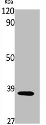 Phospho-ANXA1 (Y21) Antibody