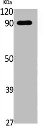 Phospho-CTNNB1 (S552) Antibody