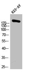 ACACA Antibody