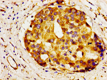 A1BG Antibody