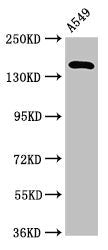 A2ML1 Antibody