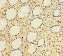 A4GNT Antibody