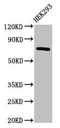 AACS Antibody