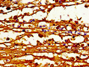 ABCB4 Antibody