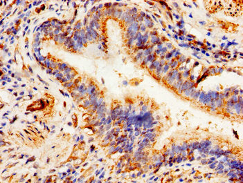 ABCD1 Antibody