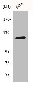 BUB1B Antibody