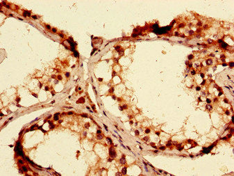 ABCG1 Antibody