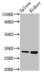 ABT1 Antibody