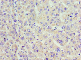 ACAA1 Antibody