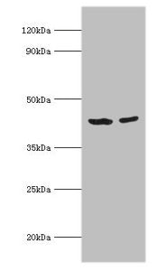 ACADS Antibody