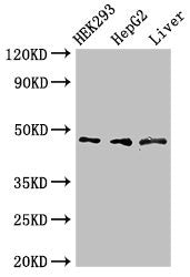 ACADSB Antibody