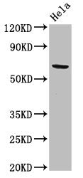 ACADVL Antibody