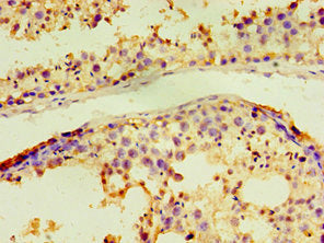 ACRV1 Antibody