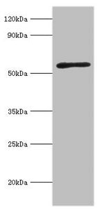 ACVR2A Antibody