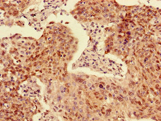ACYP2 Antibody