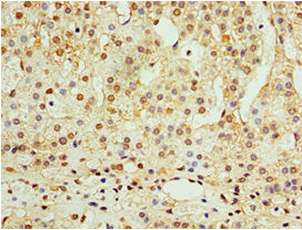 ADAP1 Antibody