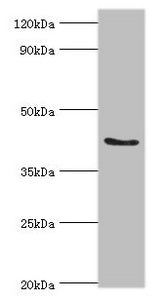 ADAP1 Antibody