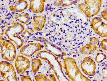 ADCY6 Antibody