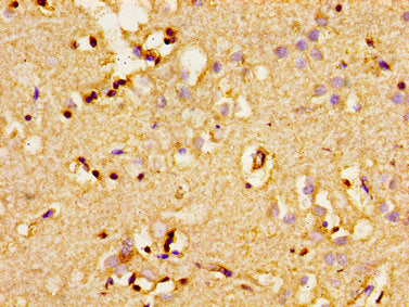 ADCY8 Antibody