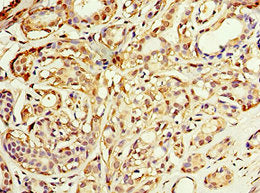 ADH1C Antibody
