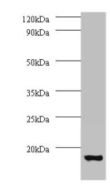 ATP6V1G1 Antibody