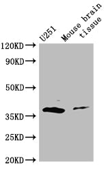 ADORA2B Antibody