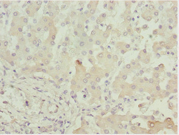 ADPGK Antibody