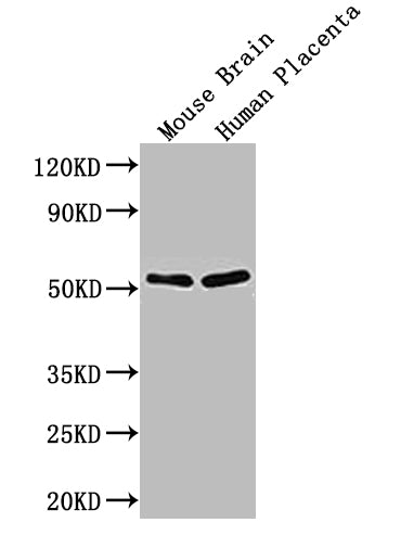 ADRB1 Antibody