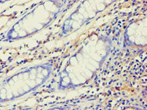 AES Antibody