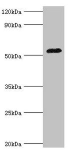 AGT Antibody
