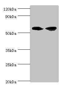 AHCYL1 Antibody