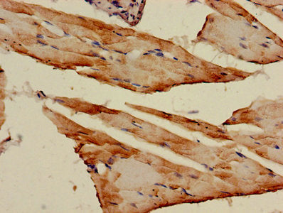 AK1 Antibody