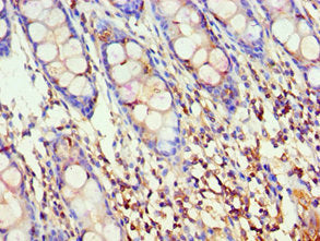 AKAP5 Antibody
