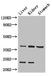 AKR1A1 Antibody
