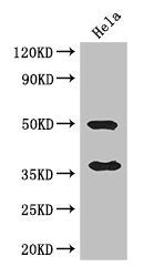 AKR1B1 Antibody